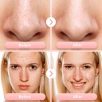 My Pores Were Clogged Until I Tried This FREESHOW Vacuum
