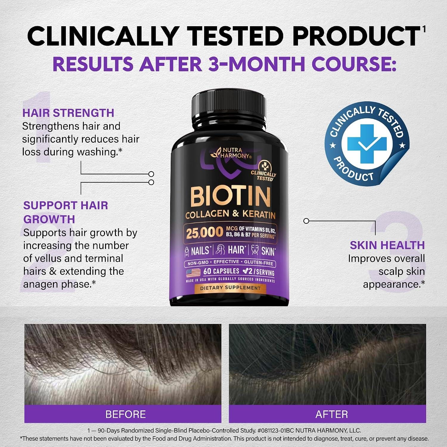 Based on the product page and customer reviews you provided, here is a concise summary of the **NUTRAHARMONY Biotin, Collagen, Hyaluronic Acid & Keratin** supplement. ### Key Takeaways from the Product Page & Reviews **What it is:** - A hair, skin, and nails supplement. - Contains a blend of **Biotin (25,000mcg), Collagen, Hyaluronic Acid, Keratinand B-Vitamins (B1, B2, B3, B6, B7)** . - Sold in a 60-count bottle (1-month supply at 2 pills per day). - Manufacturer: NUTRA HARMONY LLC. - **High ranking:** #4 in Vitamin B7 (Biotin) Supplements on Amazon. **What Customers Are saying (The