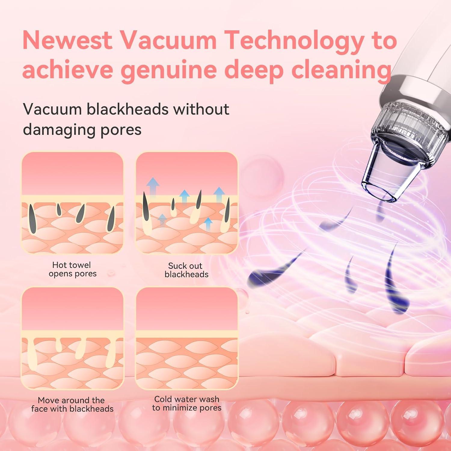 My Pores Were Clogged Until I Tried This FREESHOW Vacuum